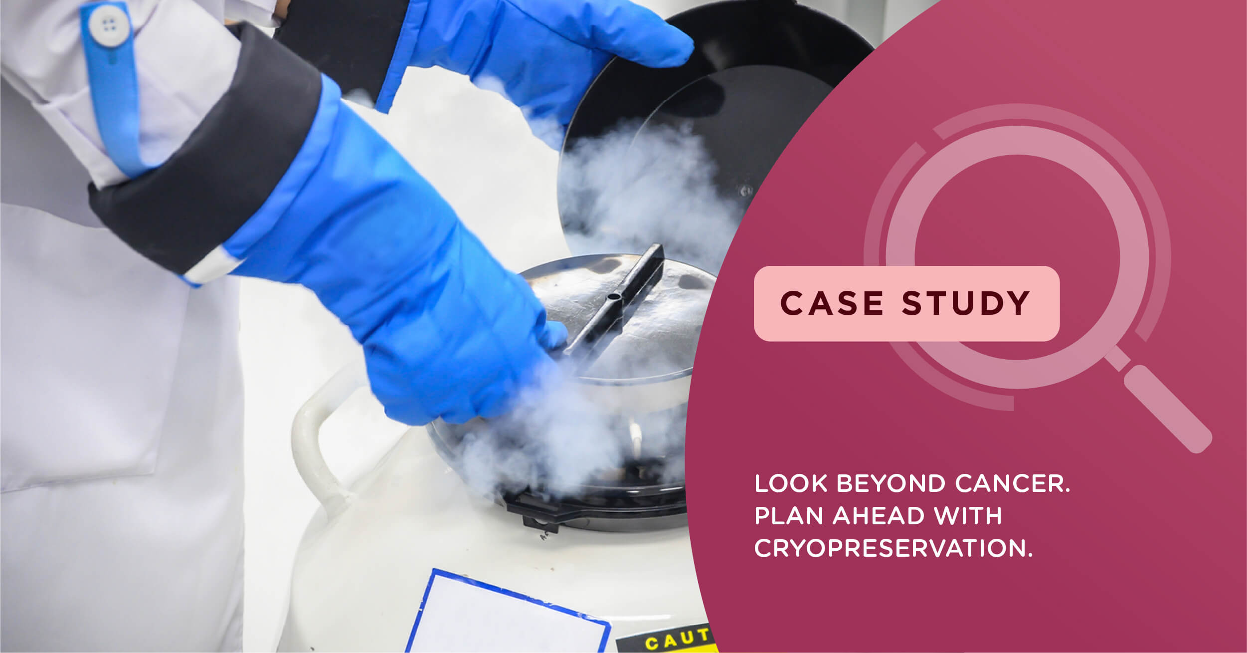 Look beyond Cancer, Plan Ahead With Cryopreservation
