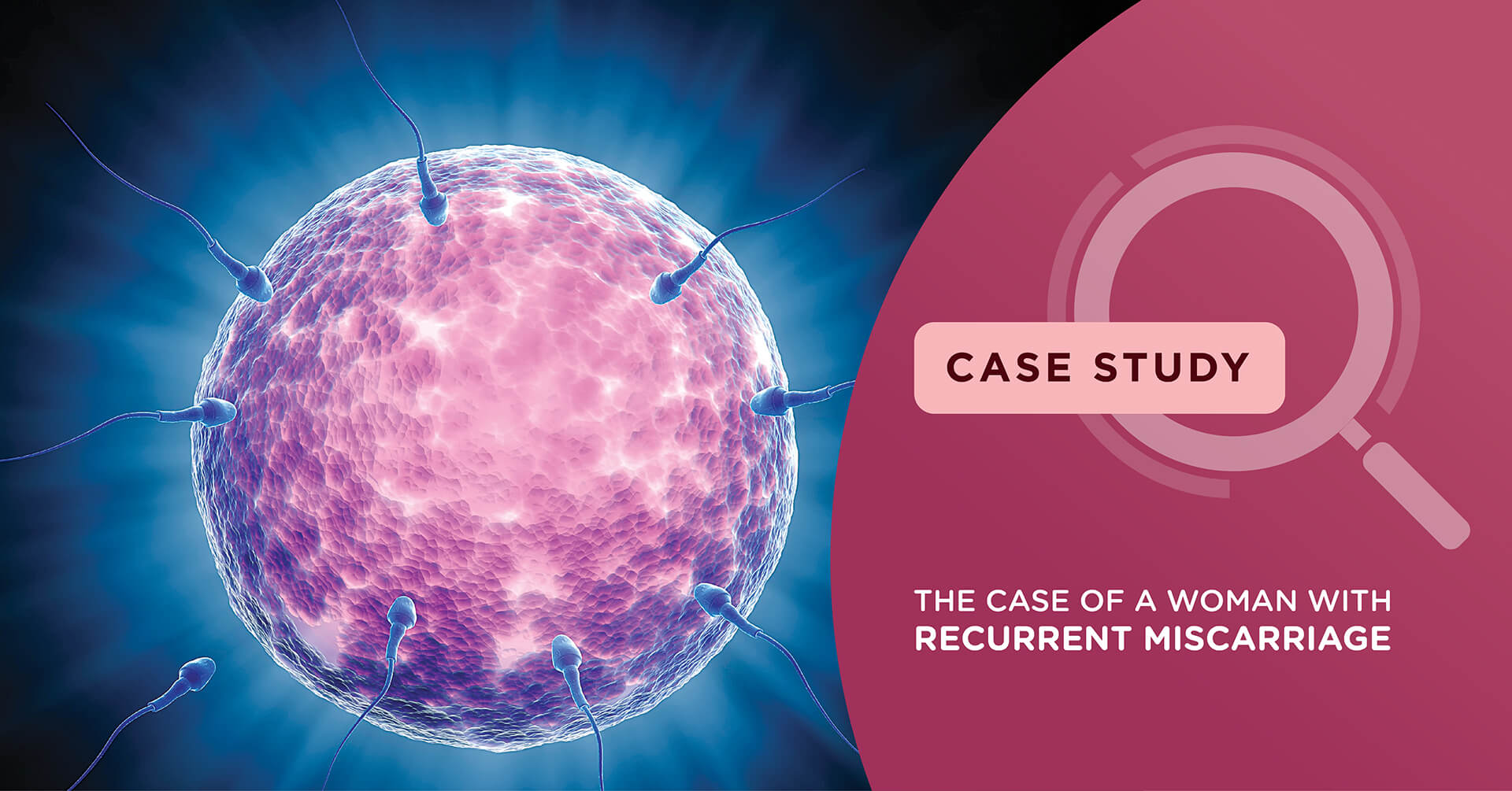 A successful pregnancy after recurrent miscarriages