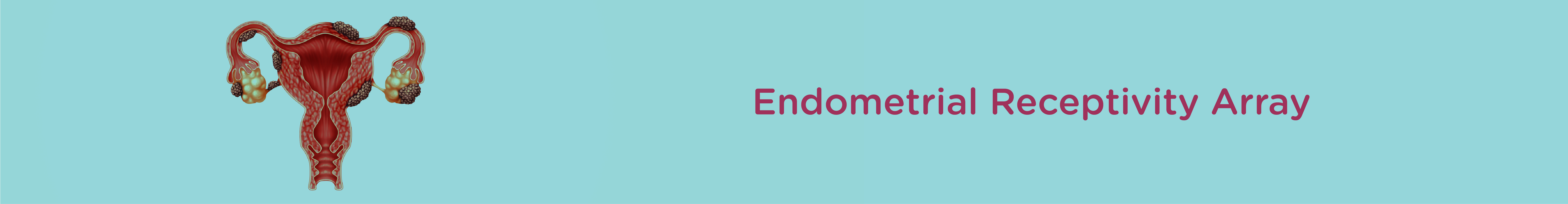 Endometrial Receptive Array