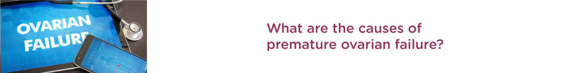 What are the causes of premature ovarian failure?