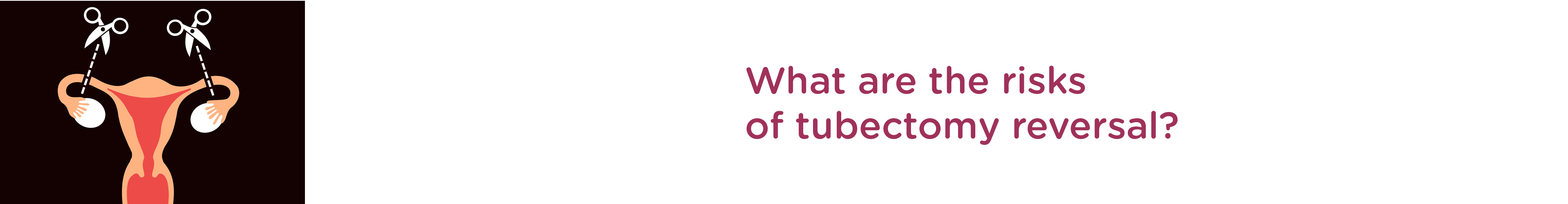 What are the Risks of Tubectomy Reversal?