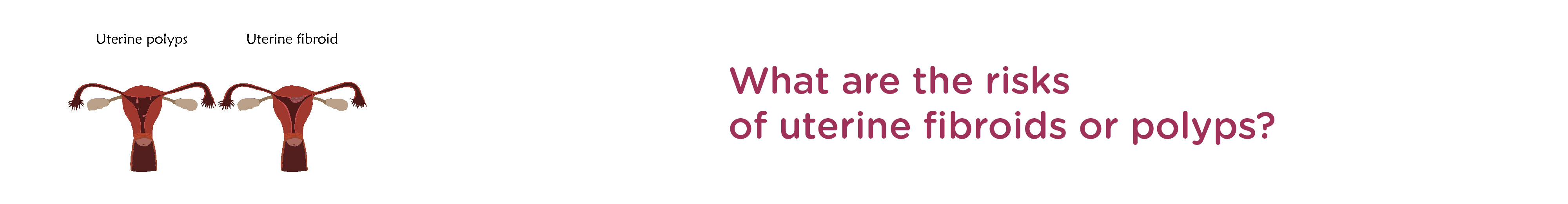 What are the Risks of Uterine Fibroids or Polyps?