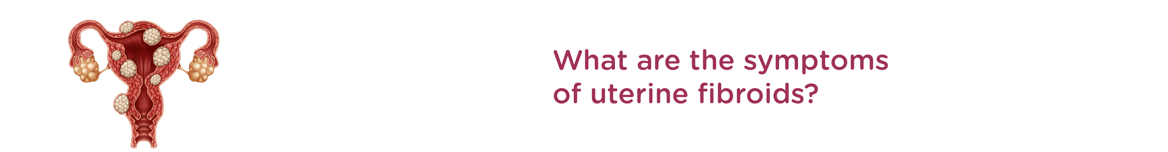 What are the Symptoms of Uterine Fibroids?