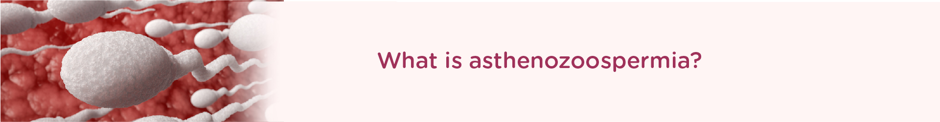 What is Asthenozoospermia?