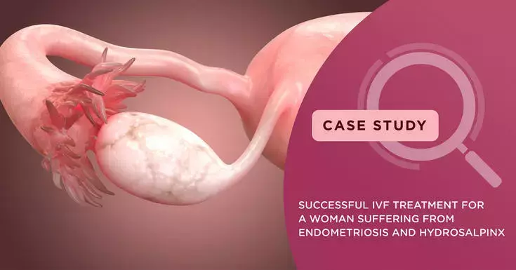 IVF treatment for successful conception for a couple with Endometriosis and Hydrosalpinx