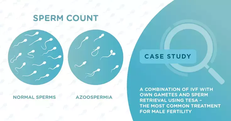A combination of IVF with own gametes and sperm retrieval using TESA – The most common treatment for male fertility 