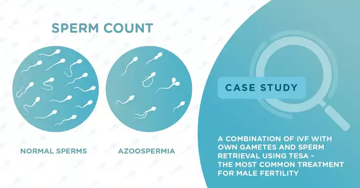 Prolactin and Infertility