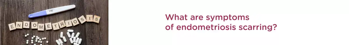 What are the Symptoms of Endometritis?