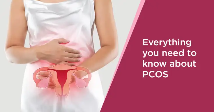 PCOS & Bloating: Why does it happen and how manage it - Fertility