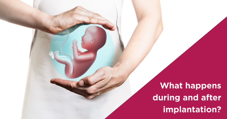 Implantation Symptoms: What Happens during & after it?