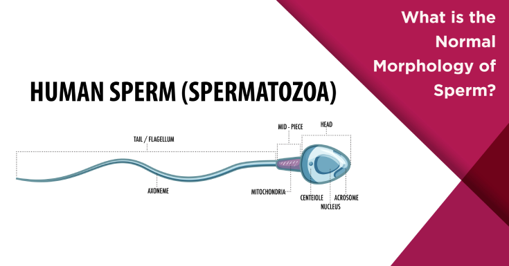 What is the Normal Morphology of Sperm?