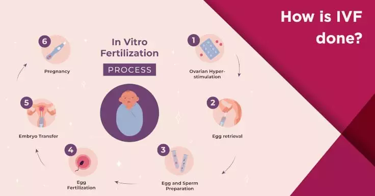 IVF Process: How is IVF done?