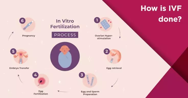 Ivf Process A Detailed Overview Of The Ivf Procedure Nova Ivf Fertility 