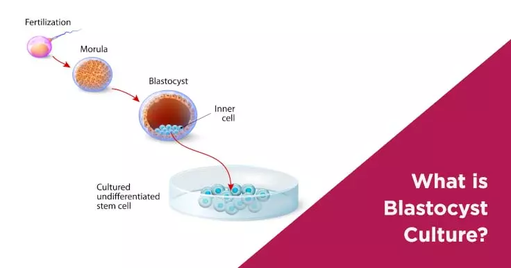 What is Blastocyst Culture?