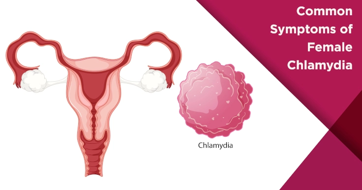 cervix with chlamydia