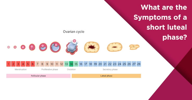 LUTEAL PHASE SYMPTOMS⚡️ The luteal phase is the time after ovulation until  your next period (healthy = 10-18 days) If you suffer fr