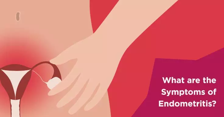 Identifying Endometriosis Scarring Symptoms