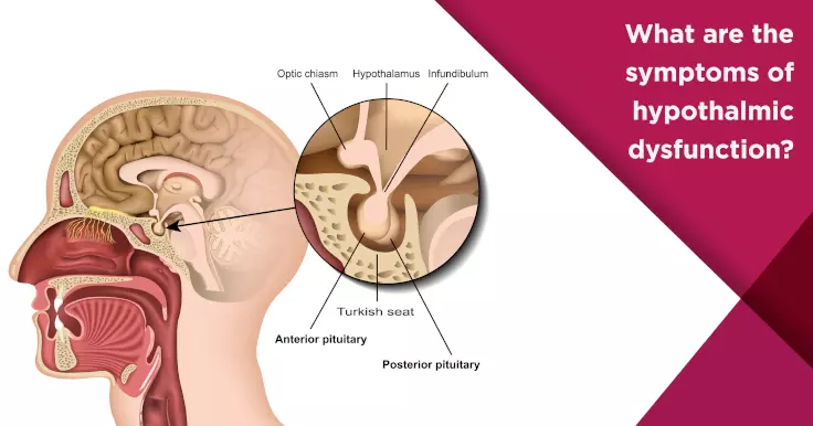 What are the symptoms of hypothalmic dysfunction?