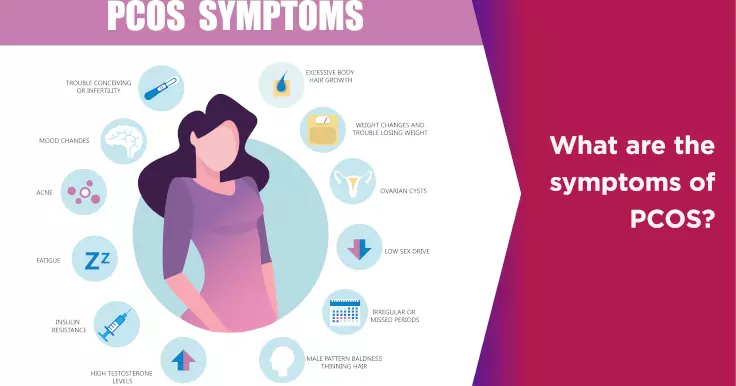 What are the symptoms of PCOS?