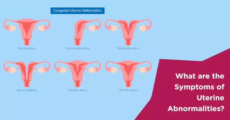 What are the Symptoms of Uterine Abnormalities?