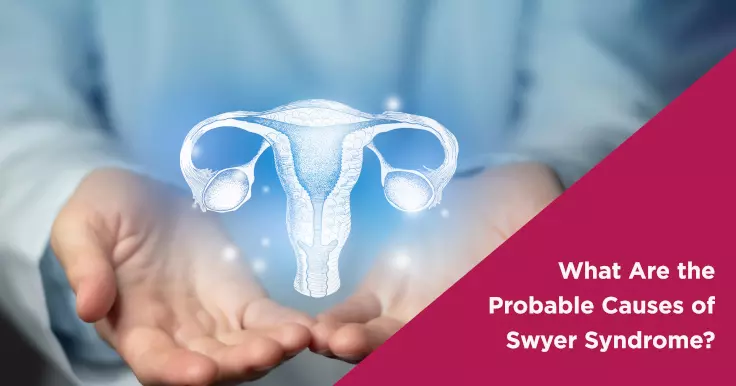 What Are the Probable Causes of Swyer Syndrome?