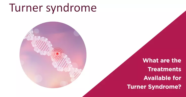 What are the Treatments Available for Turner Syndrome?