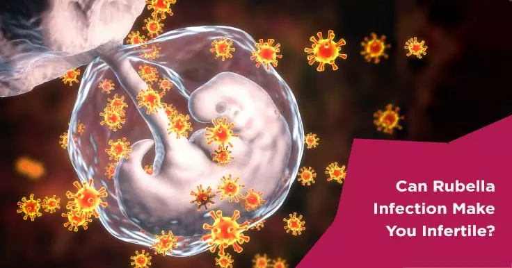 Can Rubella Infection Make You Infertile?