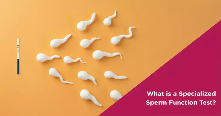 What is a Specialized Sperm Function Test?