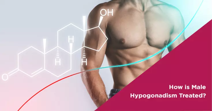 How is Male Hypogonadism Treated?