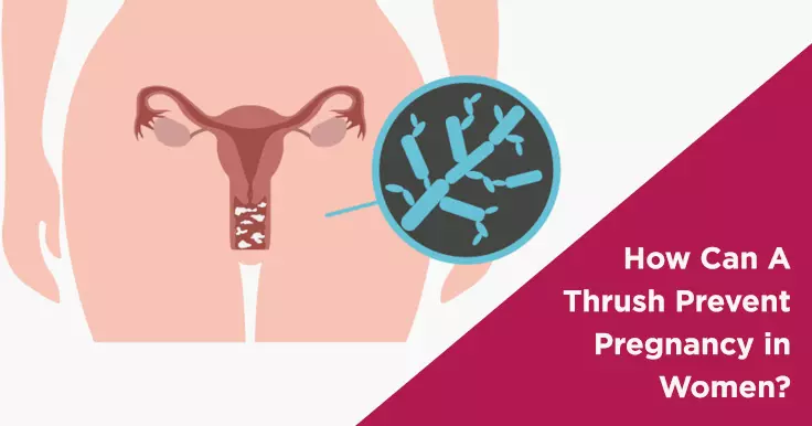 How Can A Thrush Prevent Pregnancy in Women?