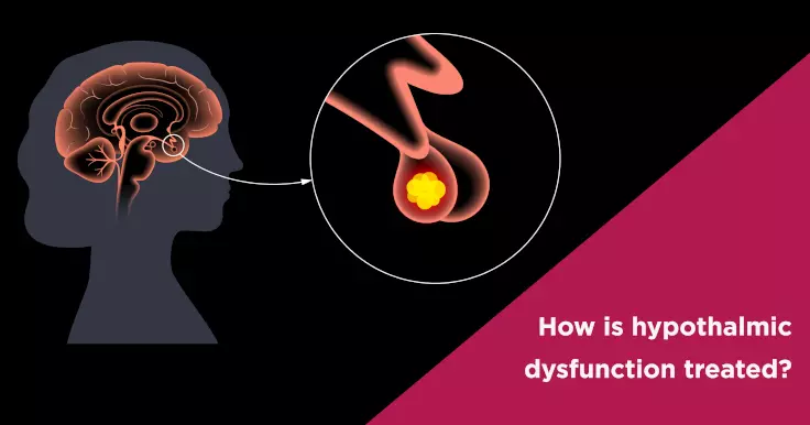 How is hypothalmic dysfunction treated?