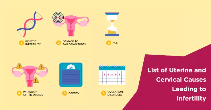 List of Uterine and Cervical Causes Leading to Infertility