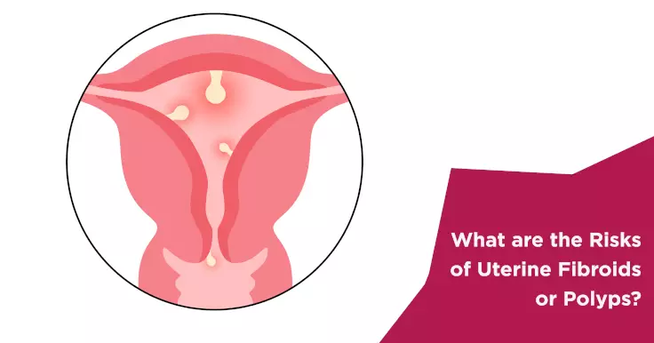 What are the Risks of Uterine Fibroids or Polyps?
