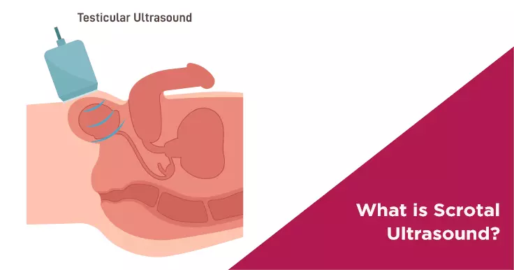 What is Scrotal Ultrasound?