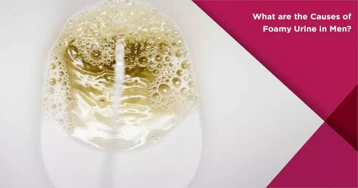 Causes of Foamy Urine in Men