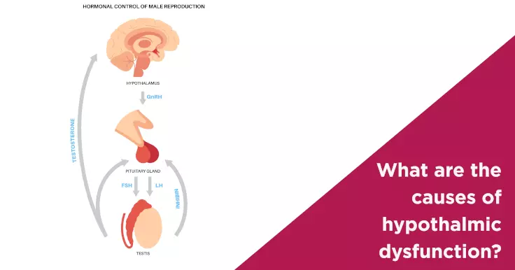 What are the causes of hypothalmic dysfunction?