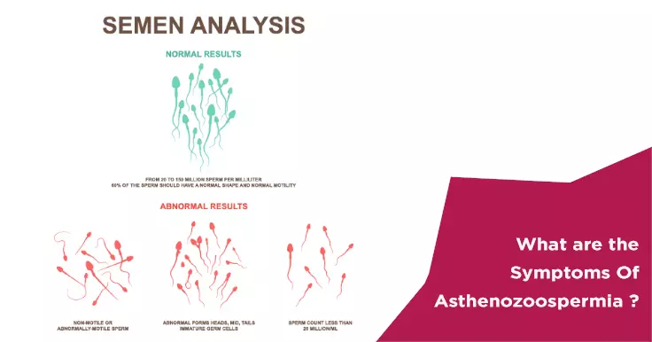 What are the Symptoms Of Asthenozoospermia ?