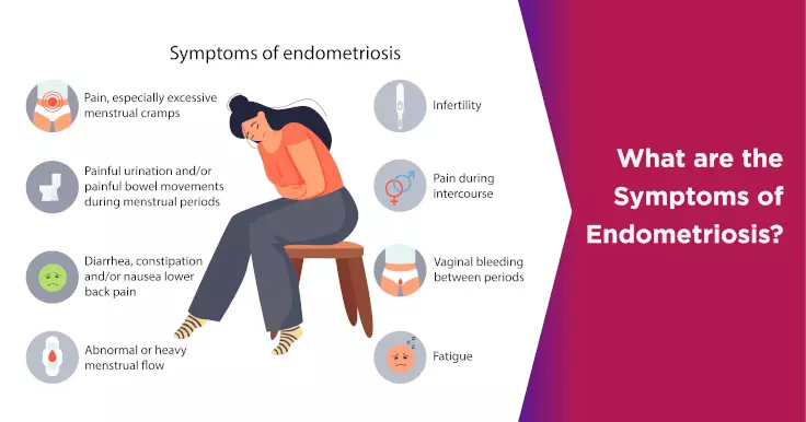What are the Symptoms of Endometriosis?