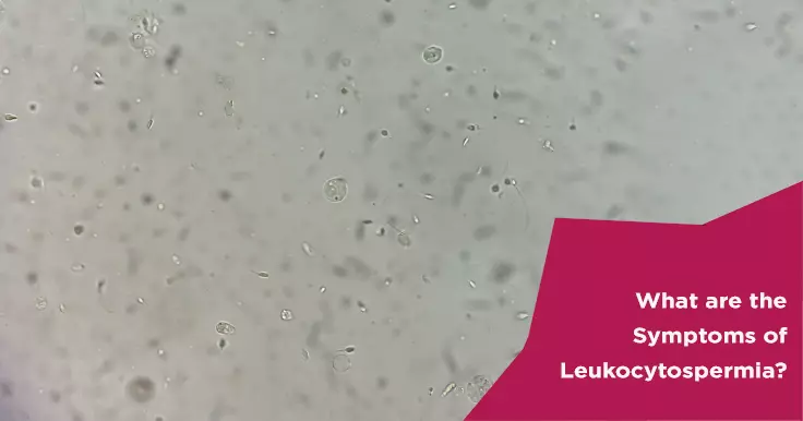 What are the Symptoms of Leukocytospermia?