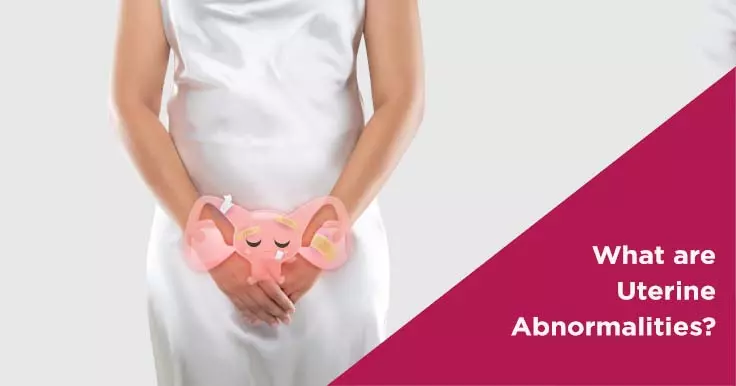 What are Uterine Abnormalities?