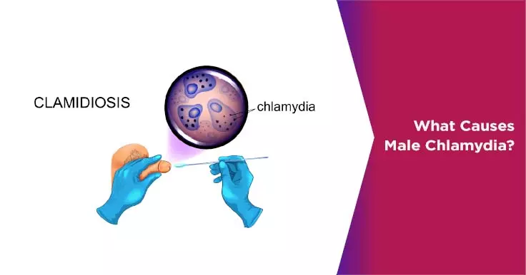 Sexually Transmitted Diseases Chlamydia