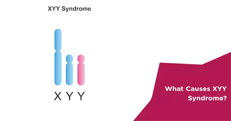 What Causes XYY Syndrome?