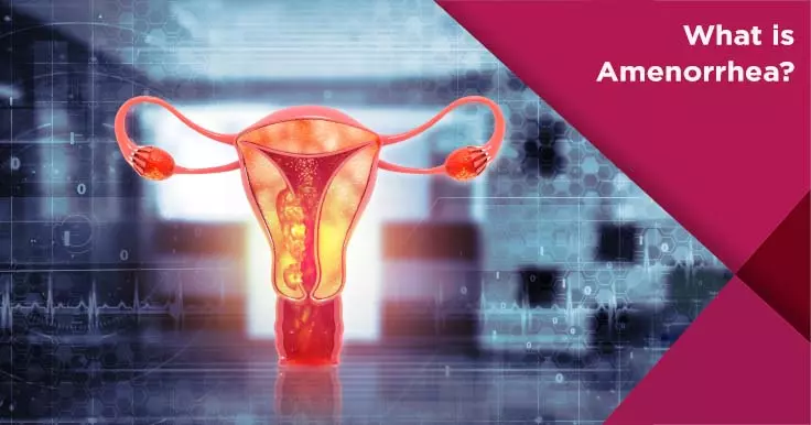 What is Amenorrhea?