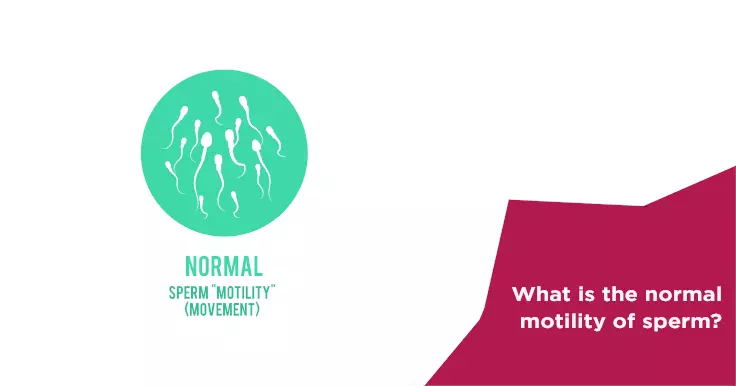 What is the normal motility of sperm?