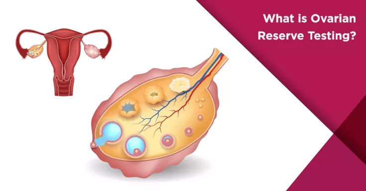 What is Ovarian Reserve Testing?