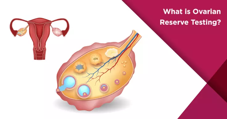 Ovarian Reserve Tests: What They Are And How To Interpret, 51% OFF