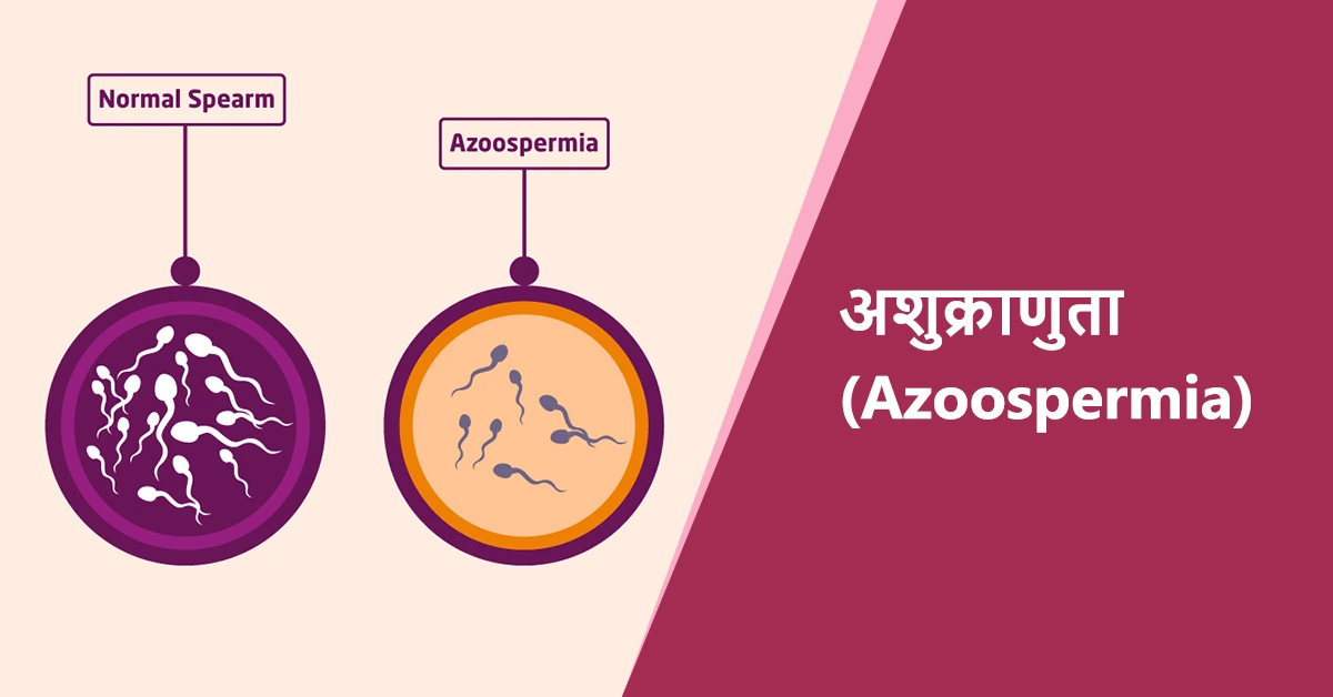 Azoospermia Meaning in Hindi