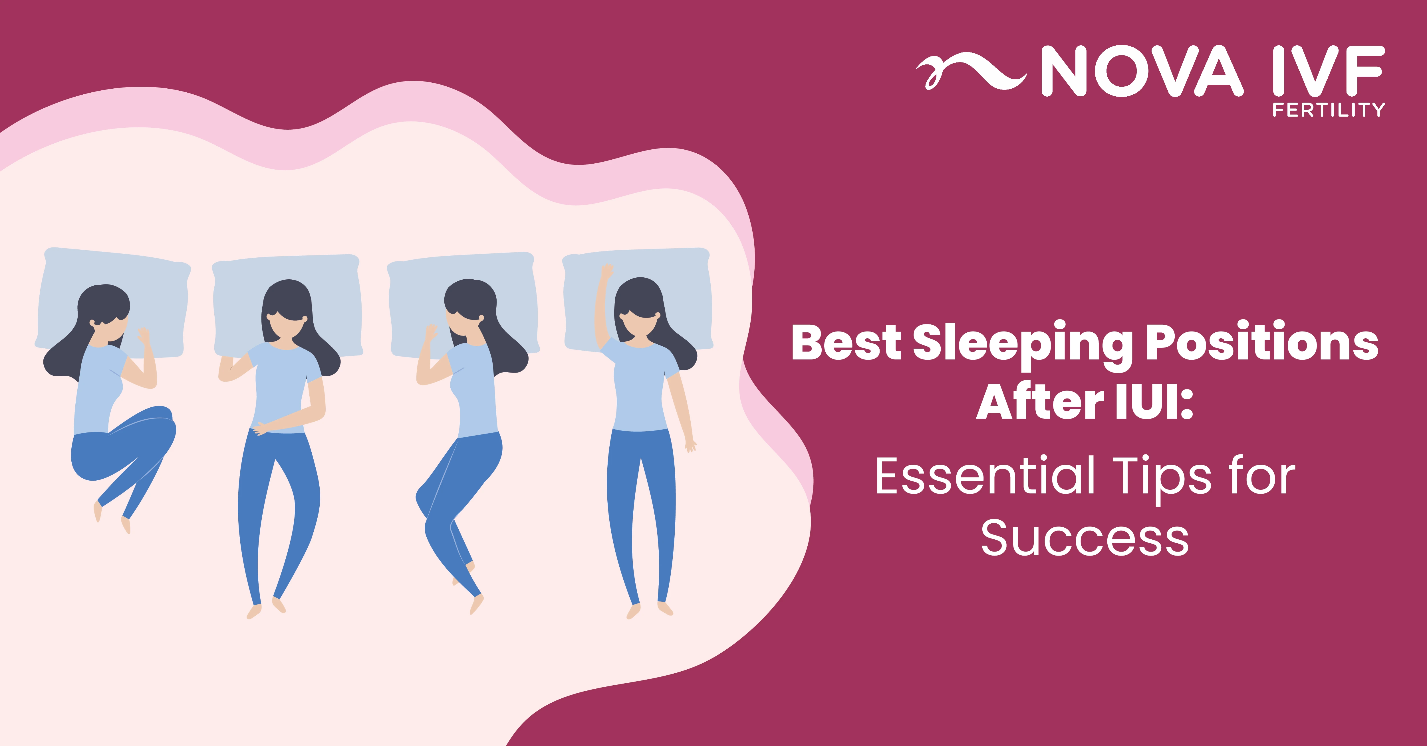  Best Sleeping Positions After IUI Treatment: Essential Tips for Success