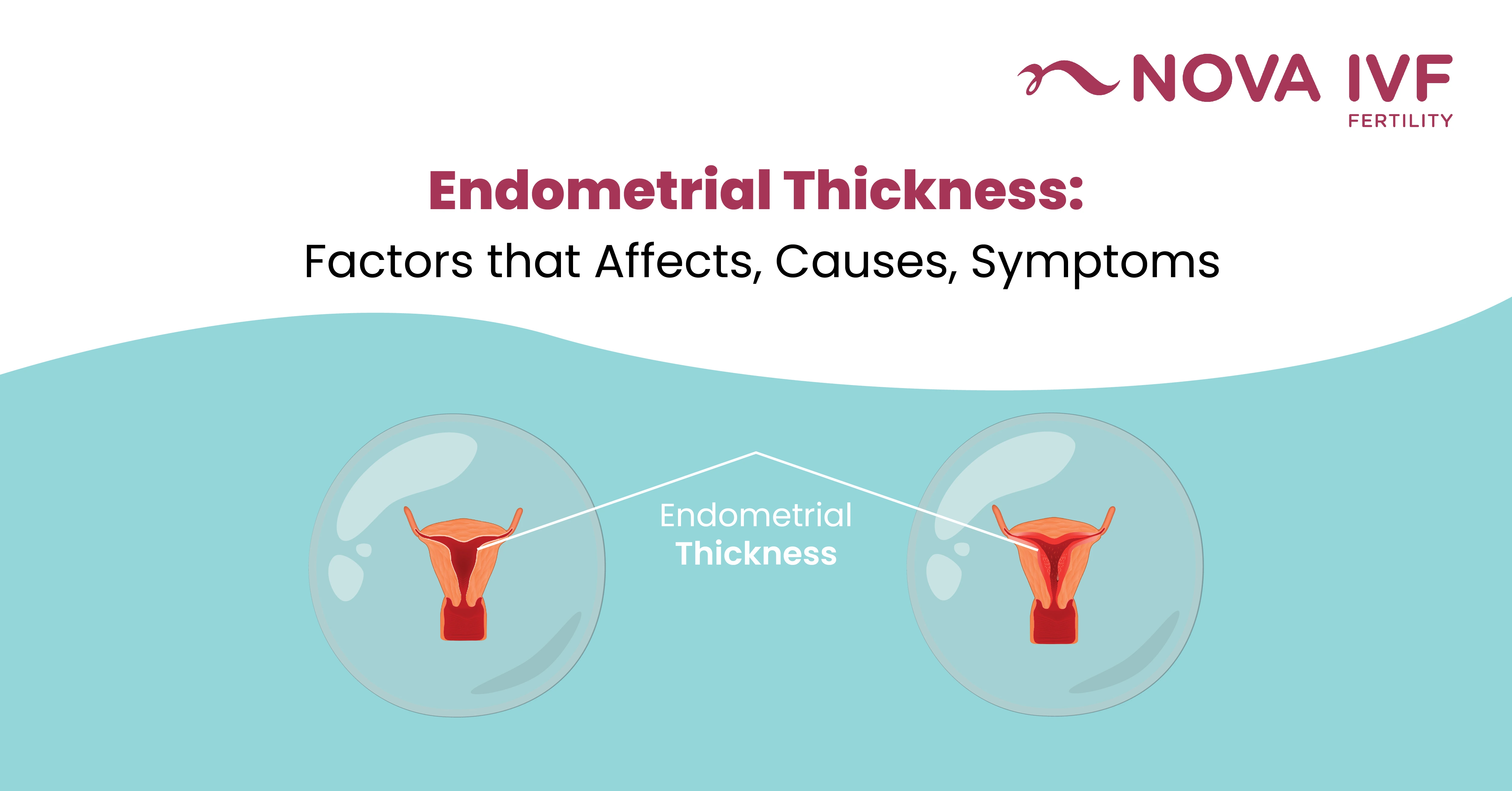  Endometrial Thickness: Factors that Affects