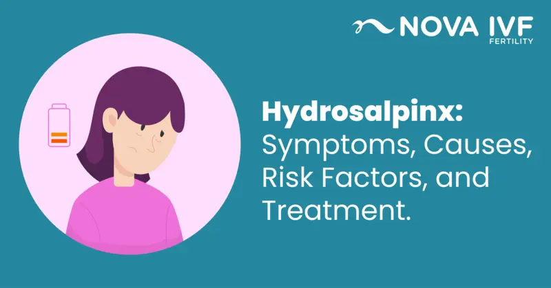 Hydrosalpinx: Symptoms, Causes, Risk Factors, and Treatment